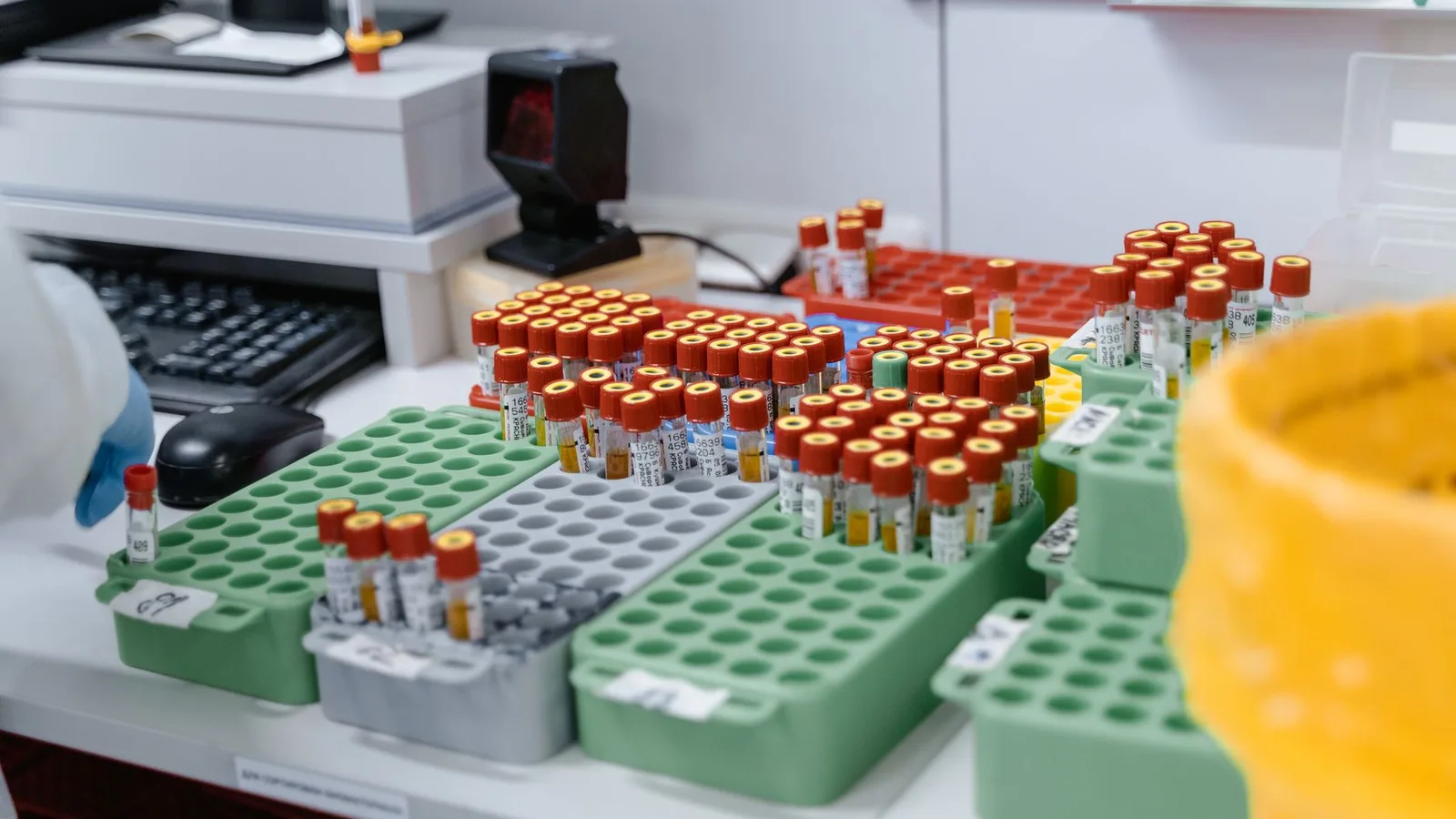 Blood samples in a lab, ready for testing and research. Organized for efficient processing.